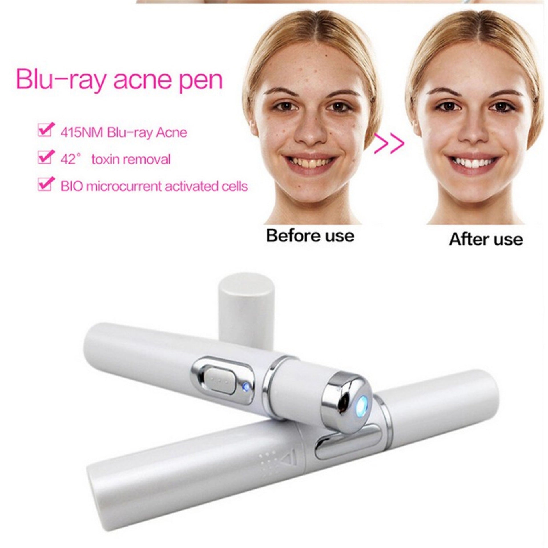 Blue Light Therapy Acne Laser Pen Soft Scar Wrinkle Removal  + Treatment Device Skin Care Beauty Equipment