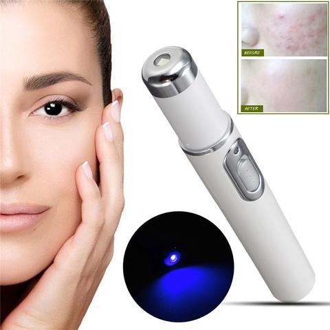 Blue Light Therapy Acne Laser Pen Soft Scar Wrinkle Removal  + Treatment Device Skin Care Beauty Equipment