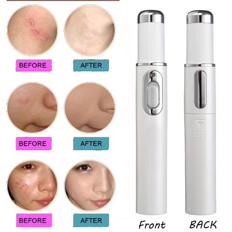 Blue Light Therapy Acne Laser Pen Soft Scar Wrinkle Removal  + Treatment Device Skin Care Beauty Equipment